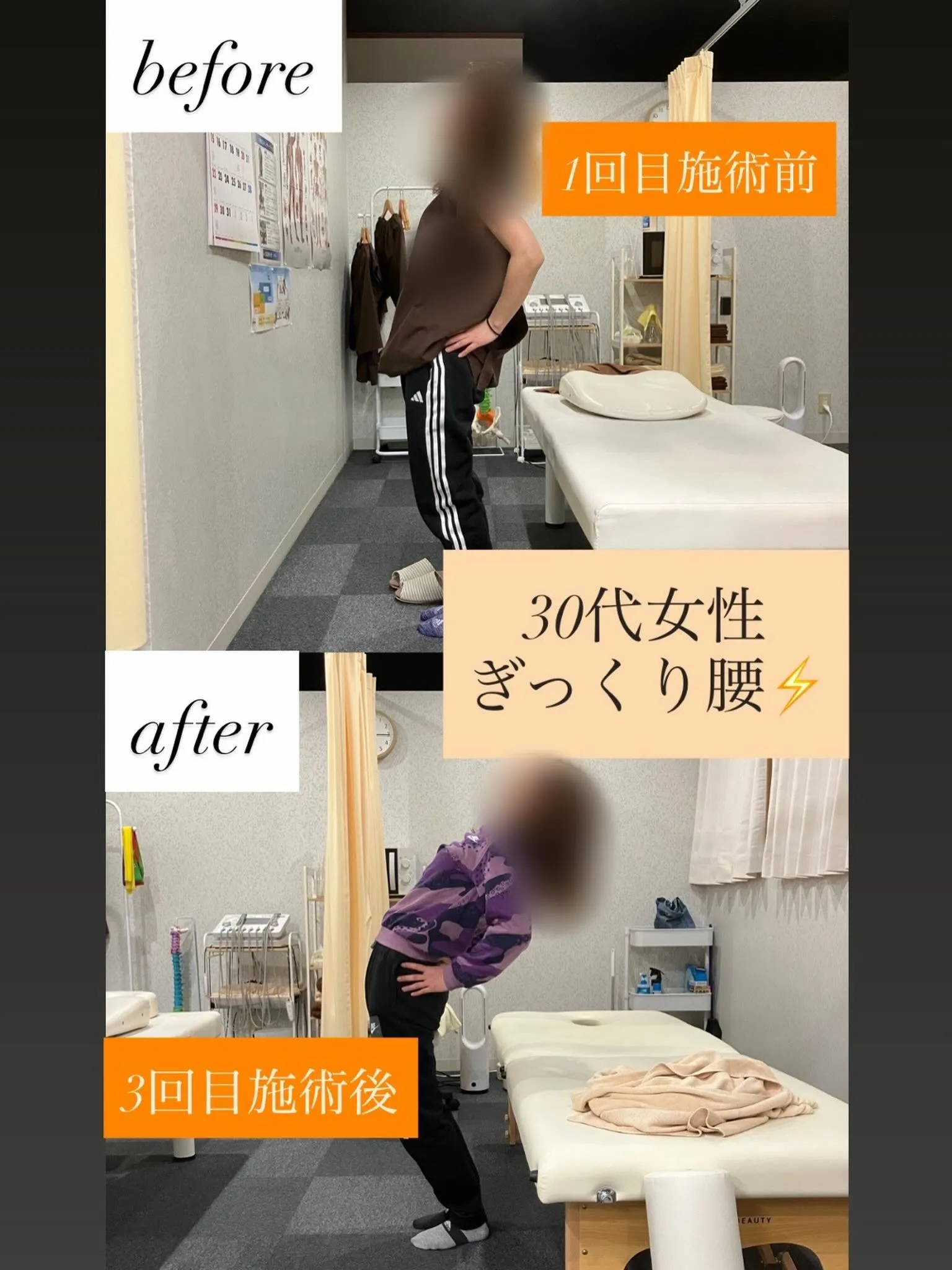 【ぎっくり腰で反れなかった腰が…】