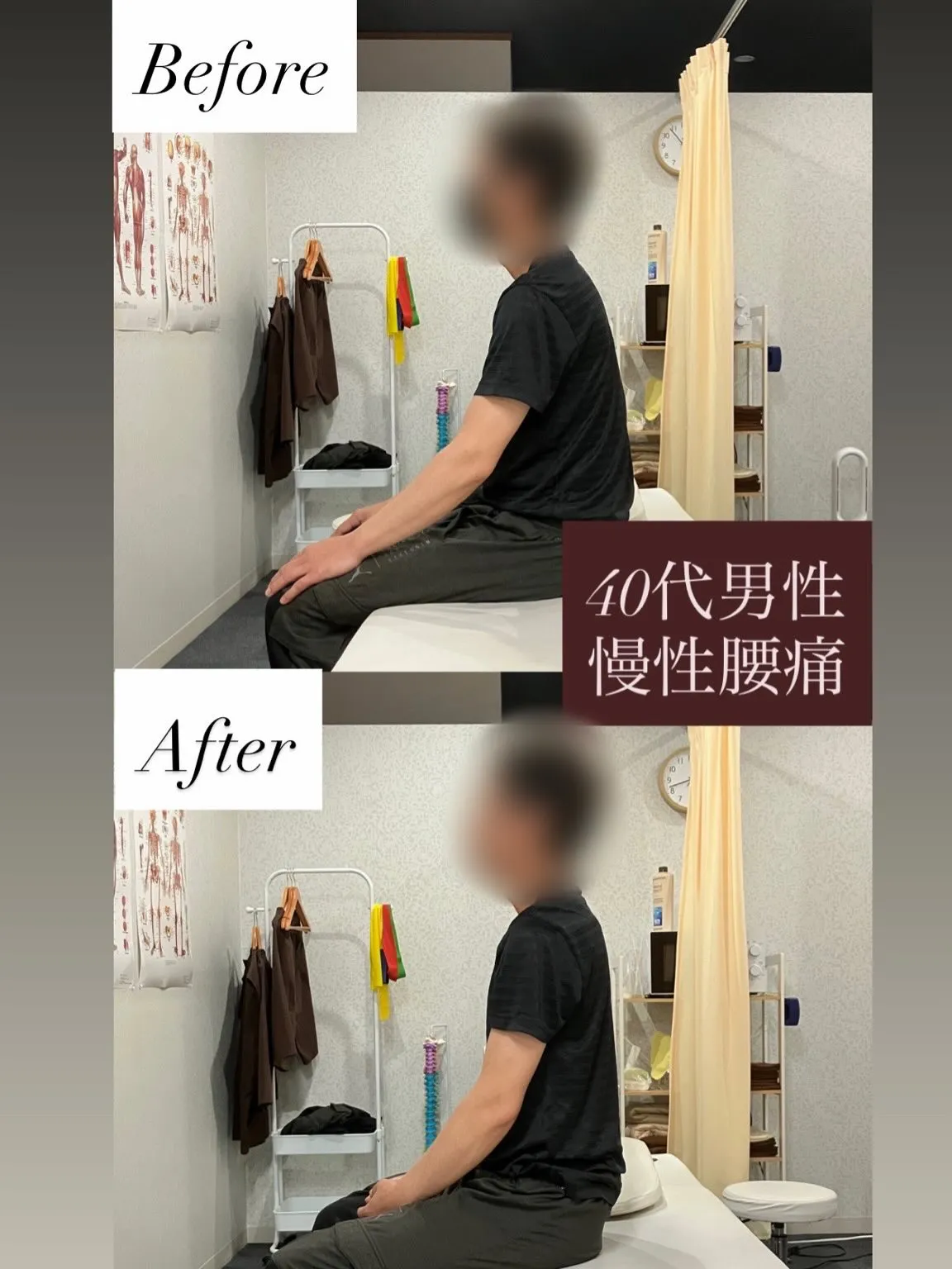 【40代男性/慢性腰痛】